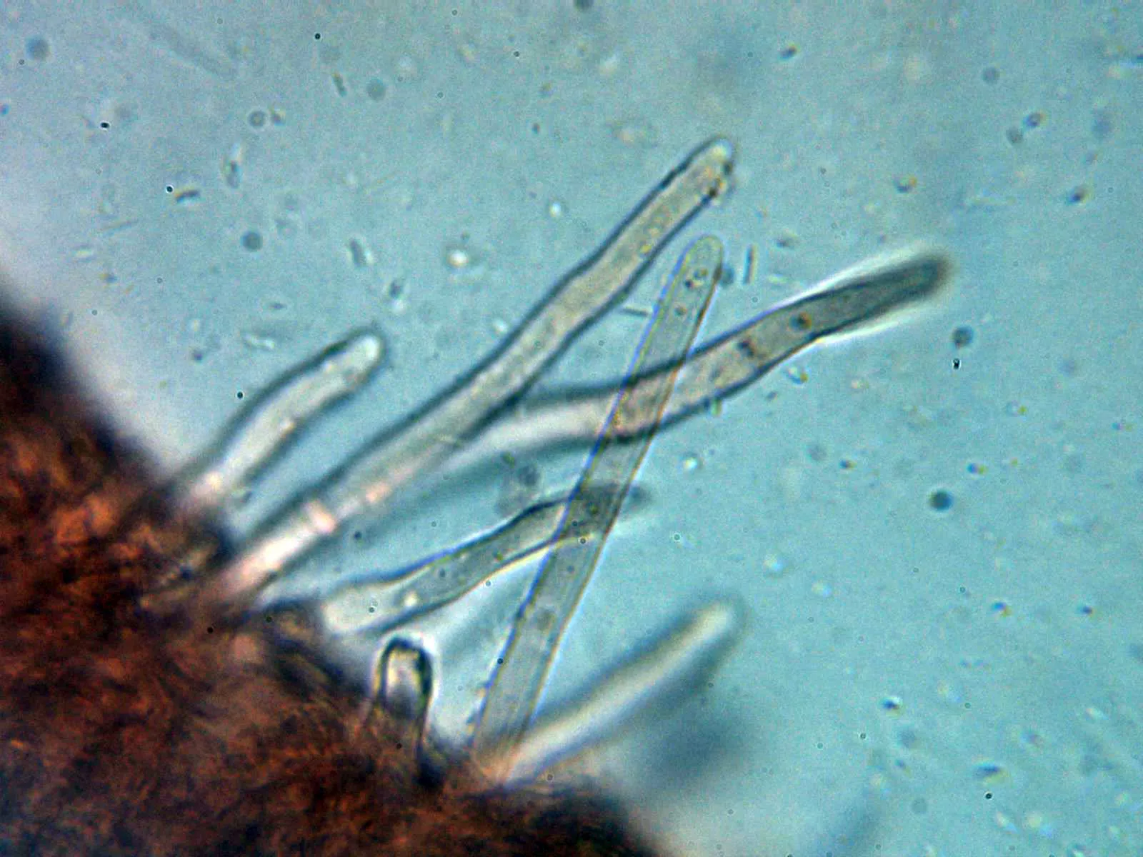 Microscopía de Tarzetta catinus - 10 - Pelos 2